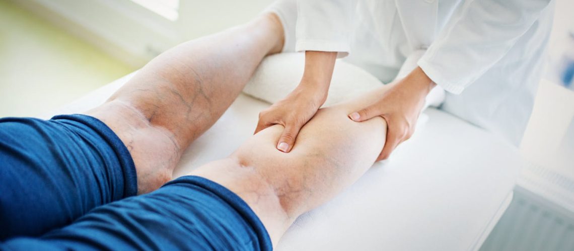 Qu'est-ce que l'angiologie ? Quand consulter un angiologue ?